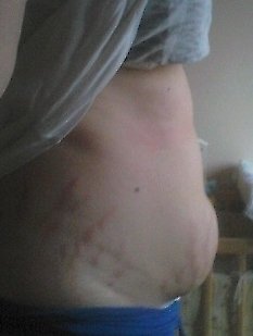przed 81 kg